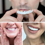 Revestimientos dentales PureSMILE™