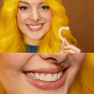Revestimientos dentales PureSMILE™